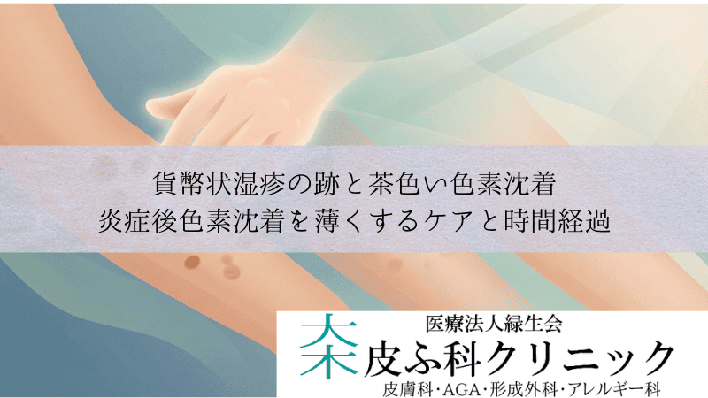貨幣状湿疹の跡と茶色い色素沈着｜炎症後色素沈着を薄くするケアと時間経過