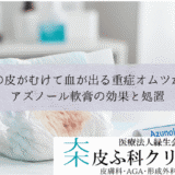 お尻の皮がむけて血が出る重症オムツかぶれ｜アズノール軟膏の効果と処置