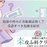 陰部の痒みに市販薬（フェミニーナ軟膏）は効く？｜受診すべき危険な症状