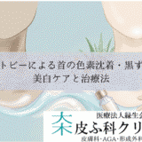 アトピーによる首の色素沈着・黒ずみ（ダーティネック）｜美白ケアと治療法