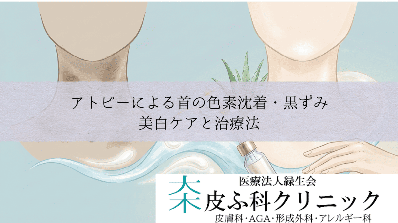 アトピーによる首の色素沈着・黒ずみ（ダーティネック）｜美白ケアと治療法