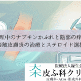 生理中のナプキンかぶれと陰部の痒み｜接触皮膚炎の治療とステロイド選択
