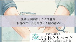 機械性蕁麻疹(人工蕁麻疹)とミミズ腫れ|下着のゴム圧迫や掻いた跡の赤み