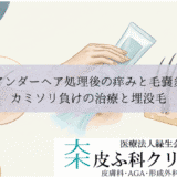 アンダーヘア処理後の痒みと毛嚢炎（毛包炎）｜カミソリ負けの治療と埋没毛