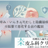 股間の痒み・いんきんたむしと陰嚢湿疹の違い｜市販薬で悪化する前の鑑別