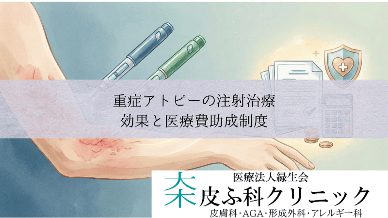 重症アトピーの注射治療（デュピクセント・ミチーガ）｜効果と医療費助成制度