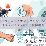 ハチ刺されによるアナフィラキシーショック｜スズメバチの2回目と抗体検査