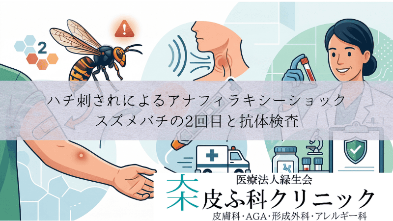 ハチ刺されによるアナフィラキシーショック｜スズメバチの2回目と抗体検査