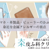 スマホ・革製品（クロム）・ビューラーのかぶれ｜身近な金属アレルギーの盲点