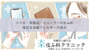 スマホ・革製品(クロム)・ビューラーのかぶれ|身近な金属アレルギーの盲点