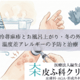 寒冷蕁麻疹とお風呂上がり・冬の外出｜温度差アレルギーの予防と治療