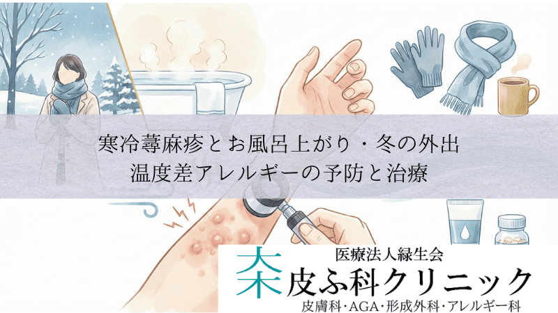 寒冷蕁麻疹とお風呂上がり・冬の外出｜温度差アレルギーの予防と治療