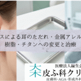 ピアスによる耳のただれ・金属アレルギー｜樹脂・チタンへの変更と治療