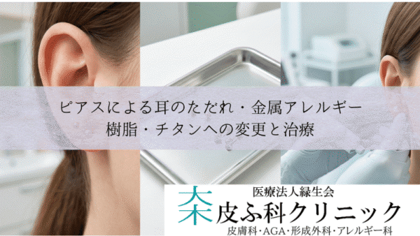 ピアスによる耳のただれ・金属アレルギー｜樹脂・チタンへの変更と治療