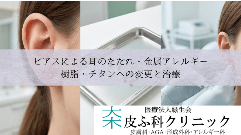 ピアスによる耳のただれ・金属アレルギー｜樹脂・チタンへの変更と治療