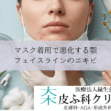 マスク着用で悪化する顎・フェイスラインのニキビ｜物理的刺激への対処