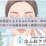 花粉皮膚炎の治療薬とステロイド｜顔の赤みに効く薬の選び方と副作用