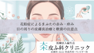 花粉皮膚炎の治療薬とステロイド｜顔の赤みに効く薬の選び方と副作用