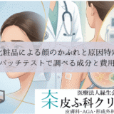 化粧品による顔のかぶれと原因特定｜パッチテストで調べる成分と費用