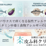 サバやナスで痒くなる仮性アレルゲン｜ヒスタミン中毒と食物アレルギーの違い