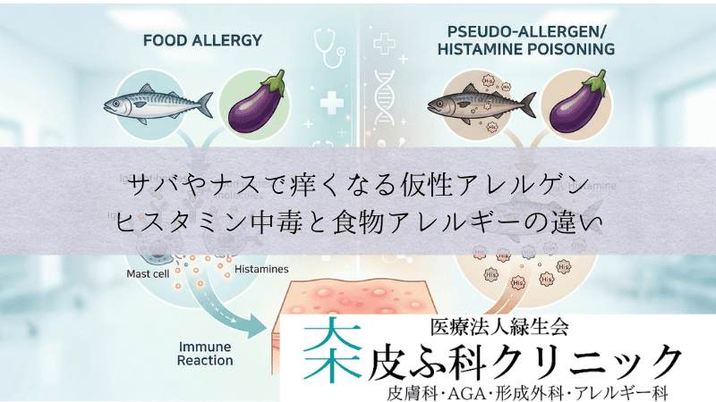 サバやナスで痒くなる仮性アレルゲン|ヒスタミン中毒と食物アレルギーの違い