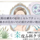 花粉皮膚炎の症状とセルフチェック｜鼻水が出ないのに顔だけ痒い理由