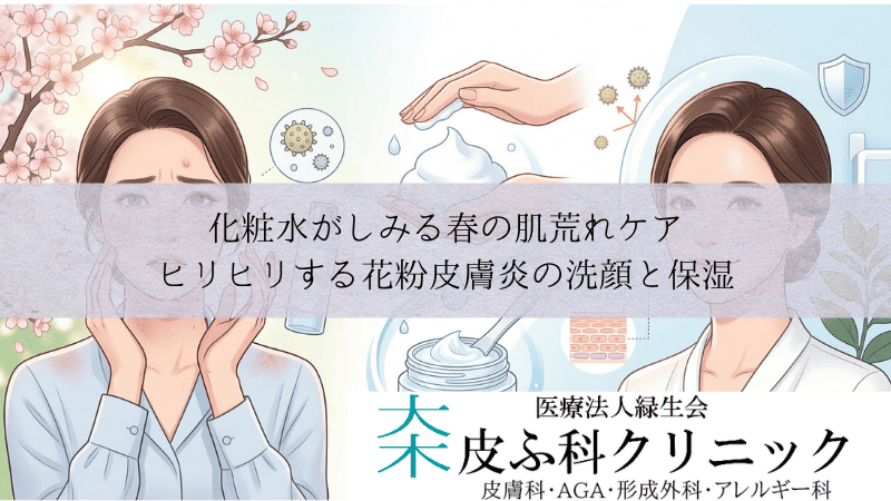 化粧水がしみる春の肌荒れケア|ヒリヒリする花粉皮膚炎の洗顔と保湿