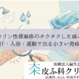 コリン性蕁麻疹のチクチクした痛み｜汗・入浴・運動で出る小さい発疹