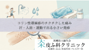 コリン性蕁麻疹のチクチクした痛み｜汗・入浴・運動で出る小さい発疹