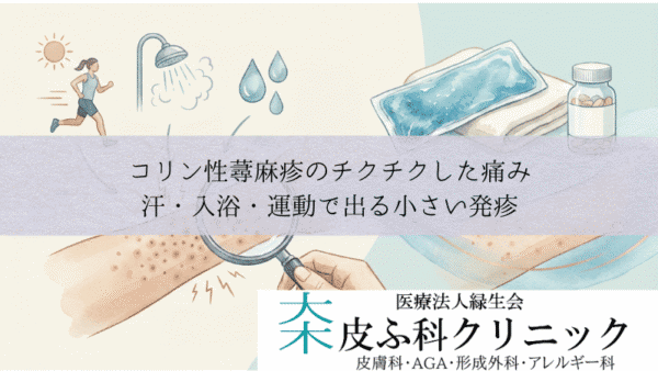 コリン性蕁麻疹のチクチクした痛み｜汗・入浴・運動で出る小さい発疹