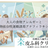 大人の食物アレルギーと食物依存性運動誘発アナフィラキシー｜小麦・甲殻類のリスク