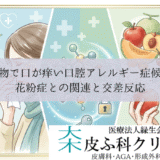 果物で口が痒い口腔アレルギー症候群（OAS）｜花粉症との関連と交差反応