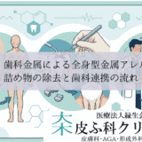 銀歯・歯科金属による全身型金属アレルギー｜詰め物の除去と歯科連携の流れ