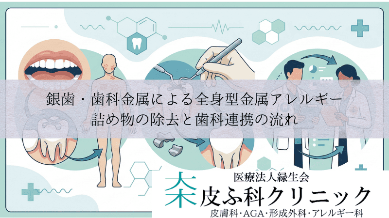銀歯・歯科金属による全身型金属アレルギー｜詰め物の除去と歯科連携の流れ