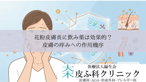 花粉皮膚炎に飲み薬（抗アレルギー薬）は効果的？｜皮膚の痒みへの作用機序