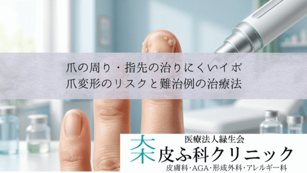 爪の周り・指先の治りにくいイボ｜爪変形のリスクと難治例の治療法