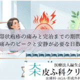帯状疱疹の痛みと完治までの期間｜痛みのピークと安静が必要な日数