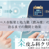 ヘルペス市販薬（軟膏）と処方薬（飲み薬）の違い｜治るまでの期間と効果