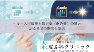 ヘルペス市販薬（軟膏）と処方薬（飲み薬）の違い｜治るまでの期間と効果