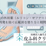 水虫の外用薬（ルリコン・ゼフナート）｜再発を防ぐ広範囲な塗り方と期間