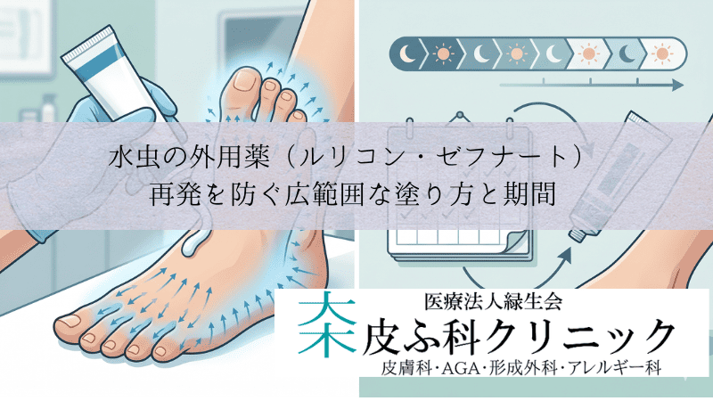 水虫の外用薬（ルリコン・ゼフナート）｜再発を防ぐ広範囲な塗り方と期間