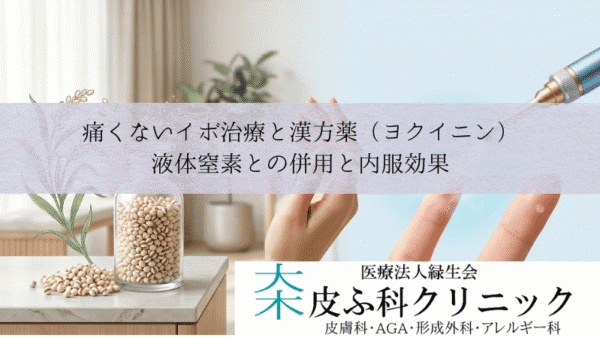 痛くないイボ治療と漢方薬（ヨクイニン）｜液体窒素との併用と内服効果