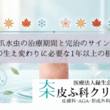爪水虫の治療期間と完治のサイン｜爪の生え変わりに必要な1年以上の根気