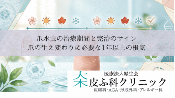爪水虫の治療期間と完治のサイン｜爪の生え変わりに必要な1年以上の根気