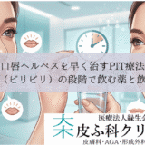 口唇ヘルペスを早く治すPIT療法｜予兆（ピリピリ）の段階で飲む薬と飲み方