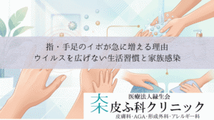 指・手足のイボが急に増える理由|ウイルスを広げない生活習慣と家族感染