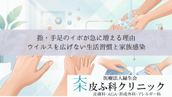 指・手足のイボが急に増える理由｜ウイルスを広げない生活習慣と家族感染