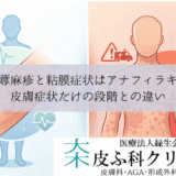 全身の蕁麻疹と粘膜症状はアナフィラキシー？｜皮膚症状だけの段階との違い