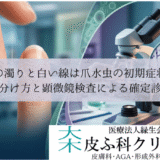 爪の濁りと白い線は爪水虫の初期症状？｜見分け方と顕微鏡検査による確定診断