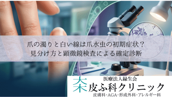 爪の濁りと白い線は爪水虫の初期症状？｜見分け方と顕微鏡検査による確定診断